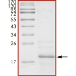 Alpha-synuclein, PLK2-phosphorylated